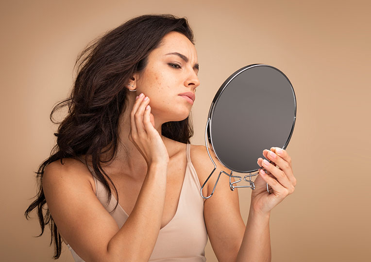 Articol Yourskin - 5 cauze ale apariției acneei la adulți și ce recomandă medicii dermatologi